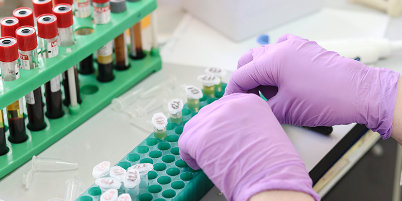 十年长青！博大博聚JSY型全自动细胞计数仪：凭什么成科研人心中的细胞计数 “经典款”？