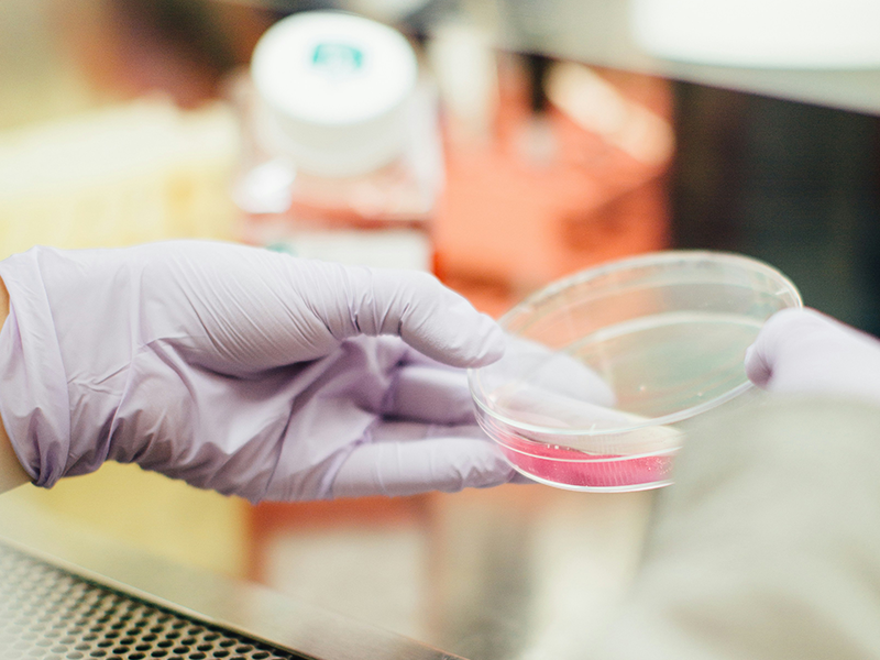 类器官行业的现在与未来——高通量成像的核心赋能作用