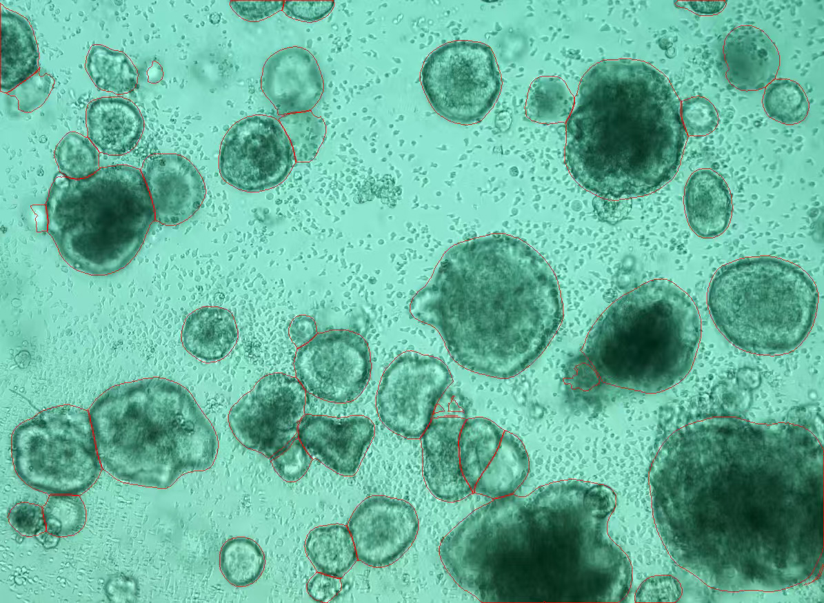 类器官成像分析