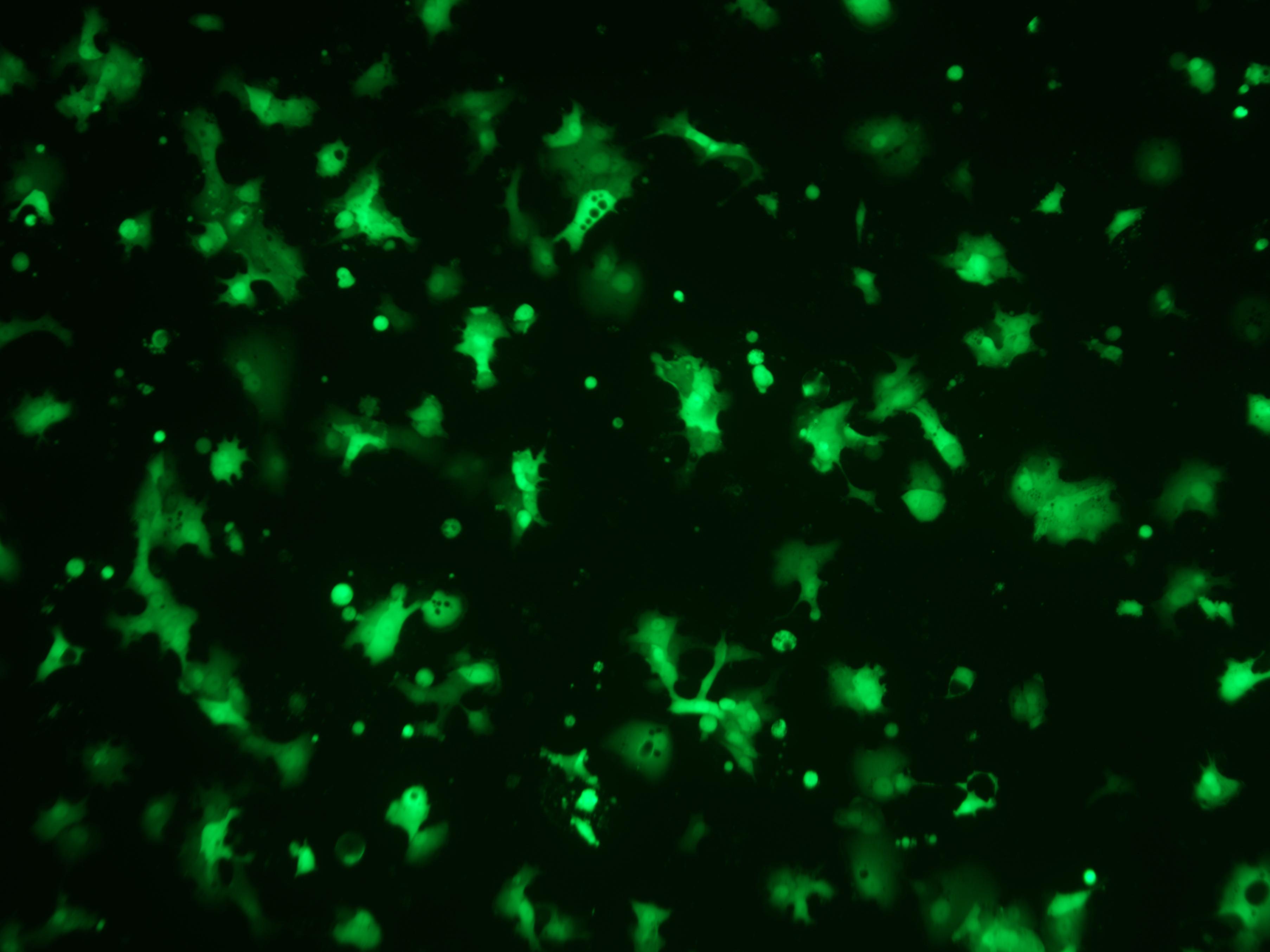 案例分享：人前列腺癌细胞荧光动态长时程成像监测