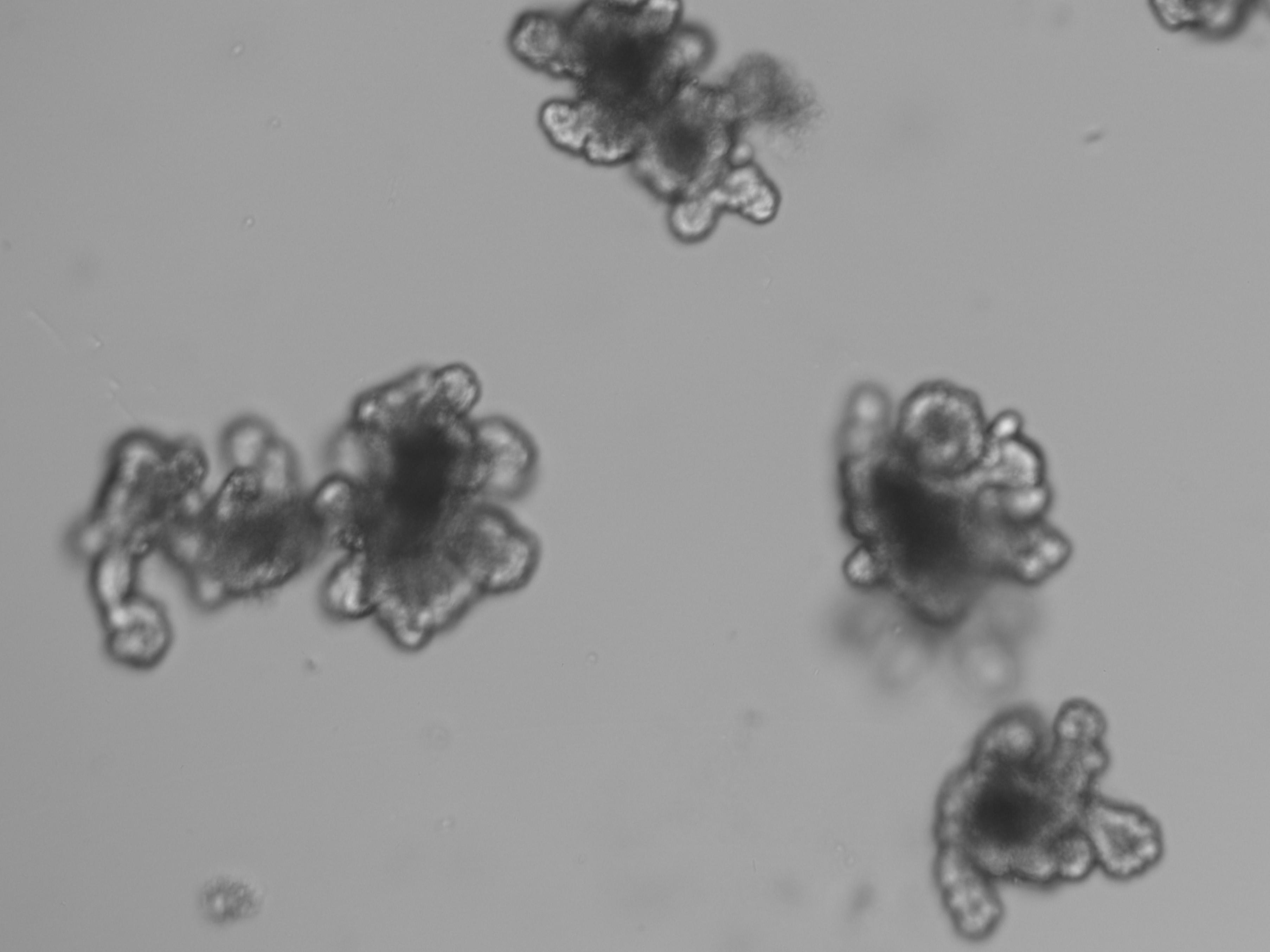 案例分享：小鼠小肠类器官Z轴多层扫描成像