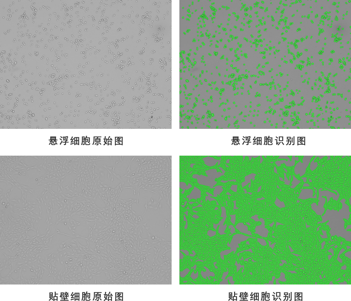 活细胞成像AI算法解决方案