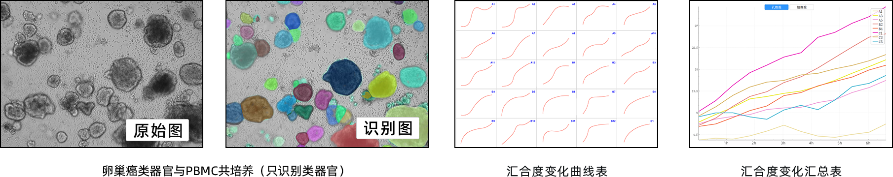 基于图像法的AI数据分析q.png