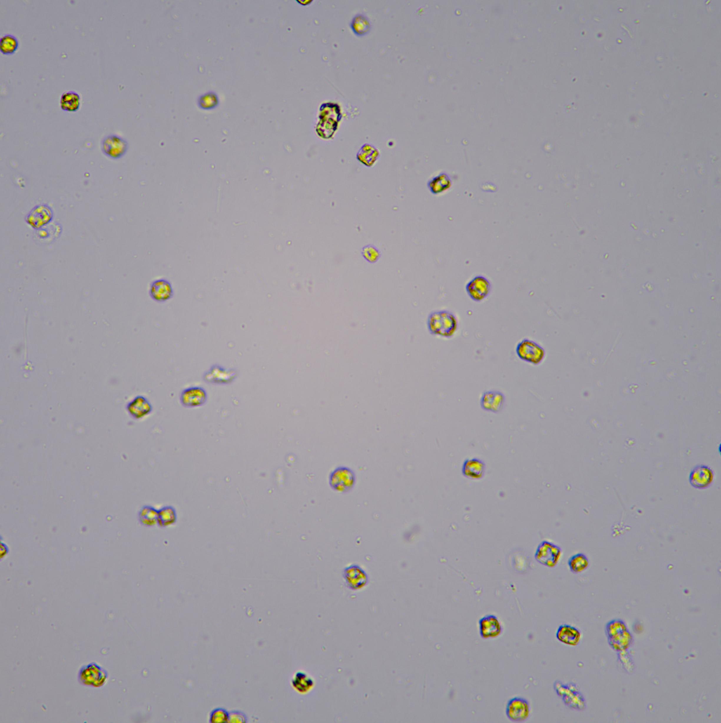 Algal cell count